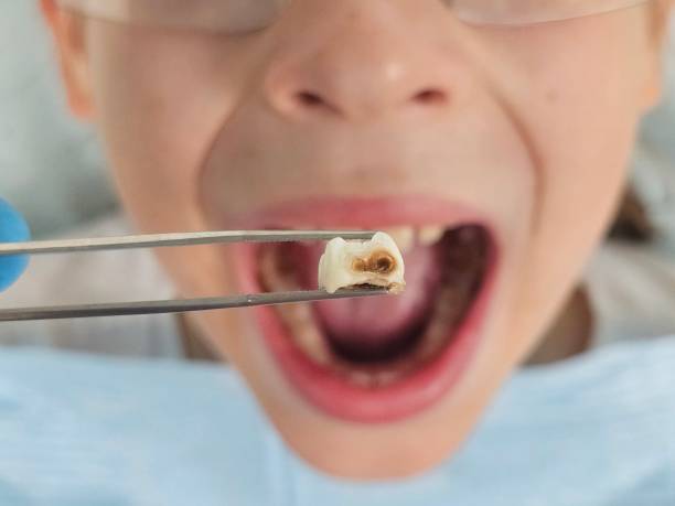 Best Emergency Treatment for Toothache in Dayton, VA