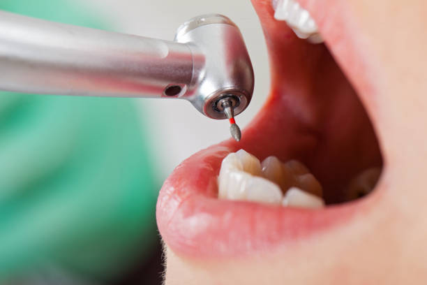 Best Emergency Broken Tooth Repair in Dayton, VA